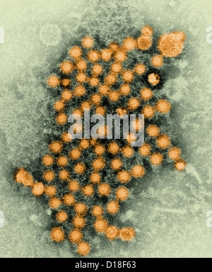 Electron micrograph of hepatitis virions Stock Photo