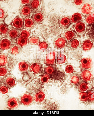 Electron micrograph, herpes virus Stock Photo