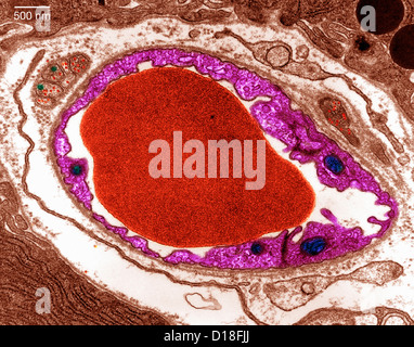 Transmission Electron micrograph pancreas Stock Photo