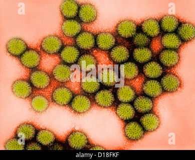 Transmission Electron micrograph of rotavirus Stock Photo