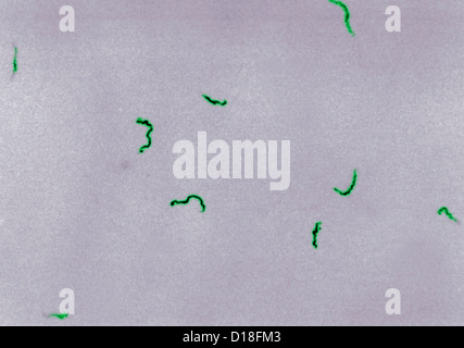 Photomicrograph of Treponema pallidum bacteria Stock Photo