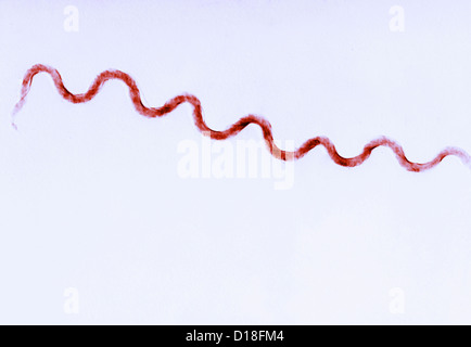 Photomicrograph of Treponema pallidum bacteria Stock Photo