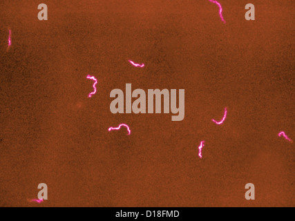 Photomicrograph of Treponema pallidum bacteria Stock Photo