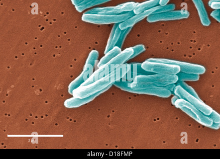 Electron micrograph of Mycobacterium tuberculosis Stock Photo