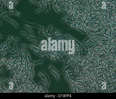 Photomicrograph of Bacillus anthracis spores Stock Photo