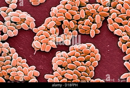 Electron micrograph of anthrax spores Stock Photo