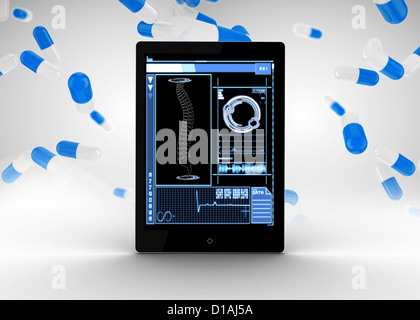 Tablet showing medical spine interface Stock Photo