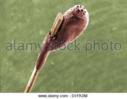 Sem Head Louse Egg On Hair Stock Photo 52590020 Alamy