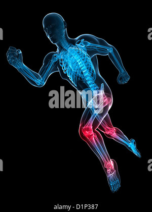 Running injuries, conceptual artwork Stock Photo