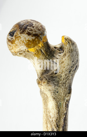 Femur bone human, close up of upper part to show the neck of femur, the commonest part to fracture - Right femur, posterior view Stock Photo