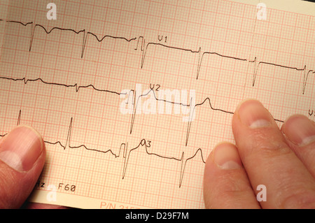 Closeup of electrocardiogram printo Stock Photo