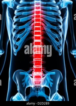 Back pain conceptual computer artwork Stock Photo - Alamy