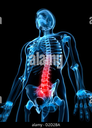 Lower back pain conceptual computer artwork Stock Photo