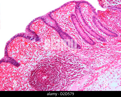 Appendix. Light micrograph of a section through a human appendix. The ...