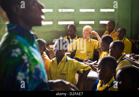 Albino boy sitting among his peers in a classroom. Stock Photo