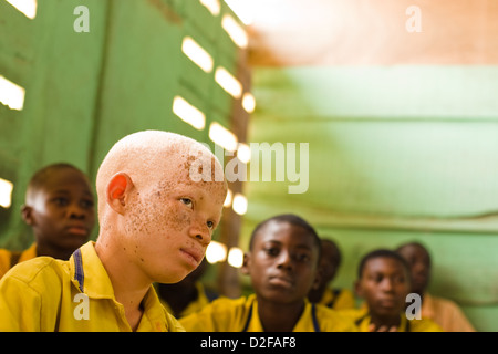 Albino boy sitting among his peers in a classroom. Stock Photo