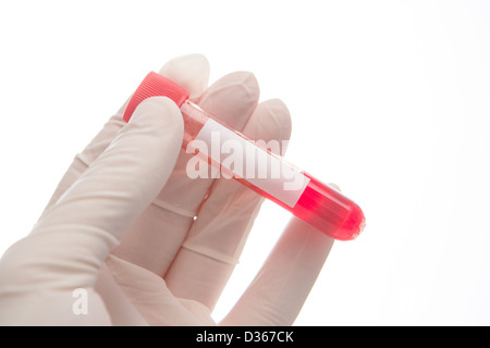 Hand in glove holding vial of blood Stock Photo