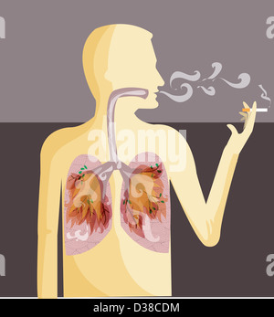 Illustrative image of human representation smoking cigarette depicting lung cancer Stock Photo