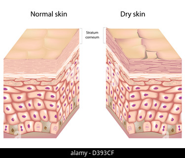 Keratinocyte Skin Cell, Illustration. This Cell Is From The Epidermis 