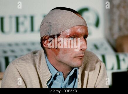 (dpa files) - Austrian Formula 1 pilot Niki Lauda with a scarred face ...