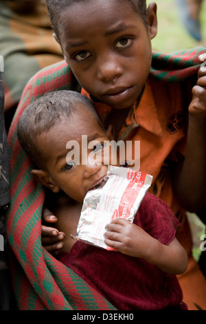 BITENA HEALTH CENTRE, WOLAYITA ZONE, SOUTHERN ETHIOPIA, 20TH AUGUST 2008: A young child eats a sachet of plumpy'nut Stock Photo