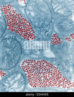 Transmission electron micrograph (TEM) of Eastern Equine Encephalitis ...