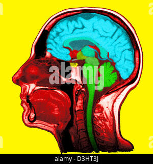 HEAD, MRI Stock Photo