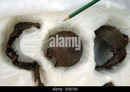 (dpa) - Body parts of a 2600 -year old bog body are presented to the public by employees of the Department for Preservation of Historical Monuments in the Uchter Moor, Germany, Monday 20 June 2005. Pictured are a jaw bone and parts of the skull. The body is of a young woman (16 -20 years old) who has died without discernable traces of external violence. The parts were found in 2000 Stock Photo