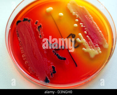 (dpa file) - A preparation in a petri dish with Pseudomonas aeruginosa ...