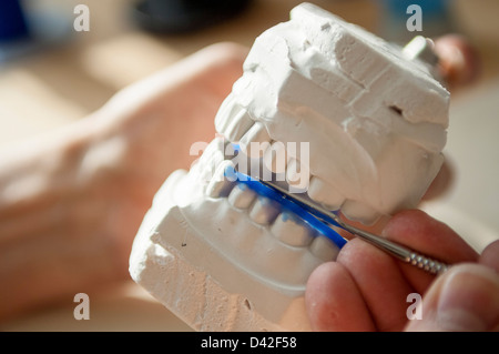 Dental technician working with a model of teeth and dental braces Stock ...
