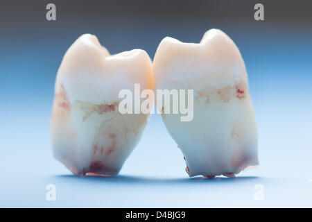 Clean extracted wisdom teeth, not fully developed. Stock Photo