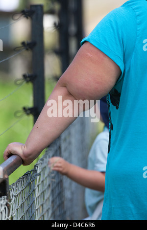 Woman's Left Arm and child's, SUPPORTRED by fence line. Illustrating extreme obesity. Stock Photo