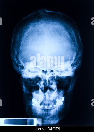 image of skull blue xray Stock Photo