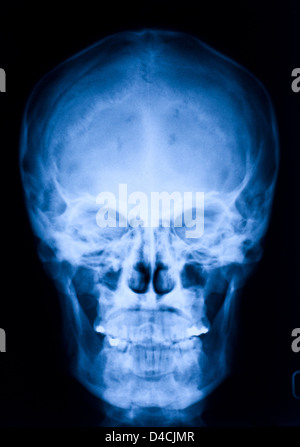 image of skull blue xray Stock Photo