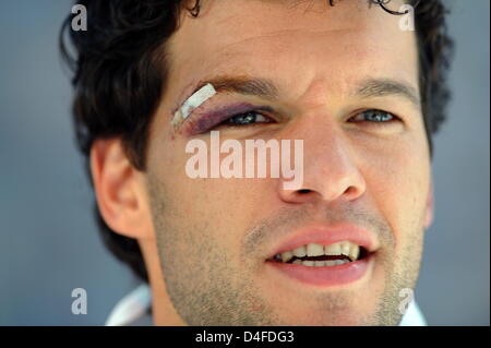 Michael Ballack, captain of Germany's national soccer team, seen with a cut above his right eye during the team reception on the streets in front of Brandenburg Gate in Berlin, Germany, 30 June 2008. Germany's national soccer team was received by hundreds of thousands of fans at Brandenburg Gate after arriving at Berlin-Tegel airport. The day before the team had lost the Euro2008 f Stock Photo