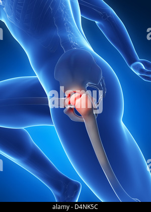 Hip joint pain Stock Photo