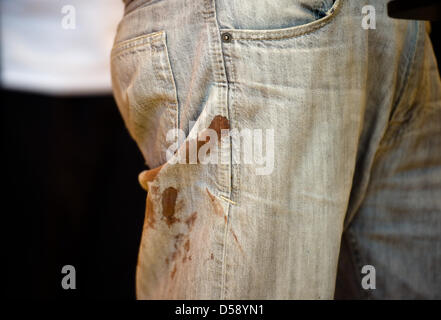 Blood is on the trousers of the assistant chairman of German International Physicians for the prevention of Nuclear War (IPPNW), Matthias Jochheim during a  press conference of The Left political party at Reichstag in Berlin, Germany, 01 June 2010. After the attack on the Gaza aid convoy shortly before the Gaza coast, he arrived back in germany and gave a press conference in front 