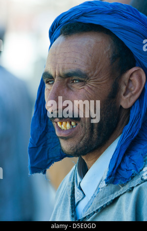 A man with bad teeth Stock Photo