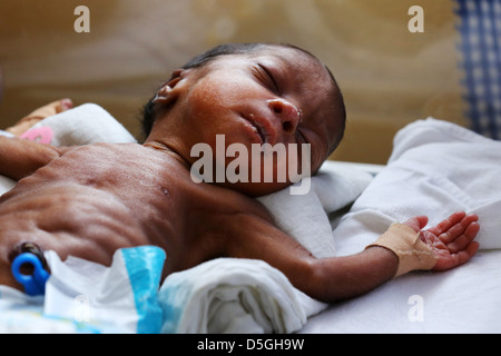 newborn premature baby boy in the maternity area of the Holy Family Hospital in Techiman, Ghana Stock Photo