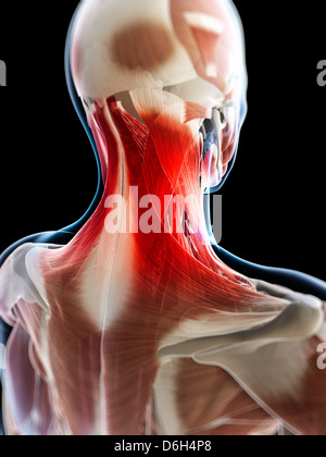 Neck pain, conceptual artwork Stock Photo