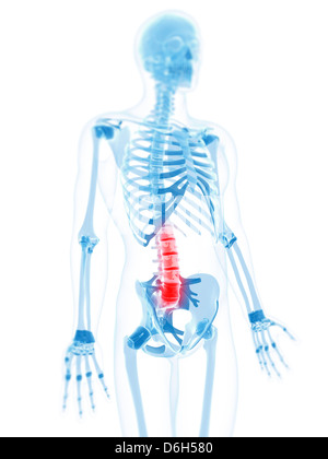 Lower back pain, conceptual artwork Stock Photo