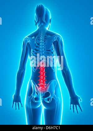 Back pain conceptual artwork Stock Photo - Alamy