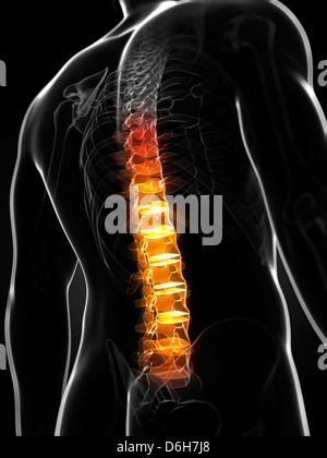 Back pain conceptual artwork Stock Photo - Alamy