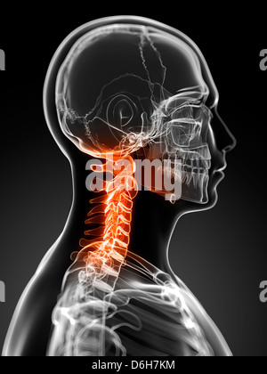 Neck pain, conceptual artwork Stock Photo