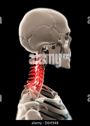 Neck pain, conceptual artwork Stock Photo