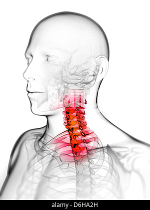 Neck pain, conceptual artwork Stock Photo