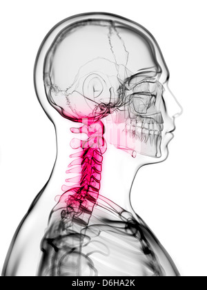 Neck pain, conceptual artwork Stock Photo