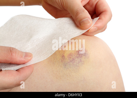 Preparing a bandage wrapped on injured knee Stock Photo