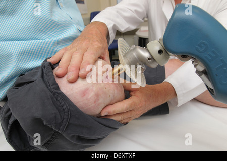 Luebeck, Germany, patients with Endo-Exo Prosthesis Stock Photo