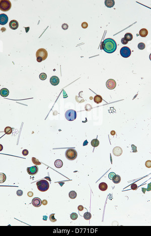 Micrograph Diatomaceae Antarctic marine diatoms) Stock Photo